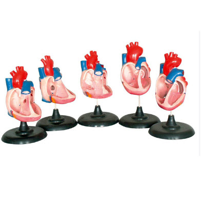 先天性心臟畸形模型 YJ/ZZ2066